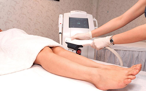 Đẹp Online | Nên waxing hay triệt lông bằng ánh sáng? | Đẹp Online