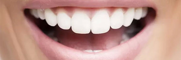 trắng răng, Đẹp online
