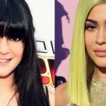 Hành trình nhan sắc của Kylie Jenner: đời thay đổi khi ta… bơm môi