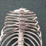 Hàn Quốc: Ca ghép xương ngực nhân tạo bằng công nghệ in 3D đầu tiên