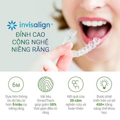 Invisalign – Bí quyết niềng răng chỉnh hô, móm, răng khấp khểnh cho người trưởng thành