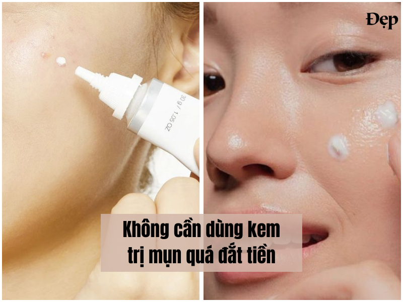 khong-can-dung-kem-tri-mun-qua-dat-tien