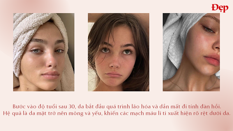 qua-trinh-lao-hoa-da