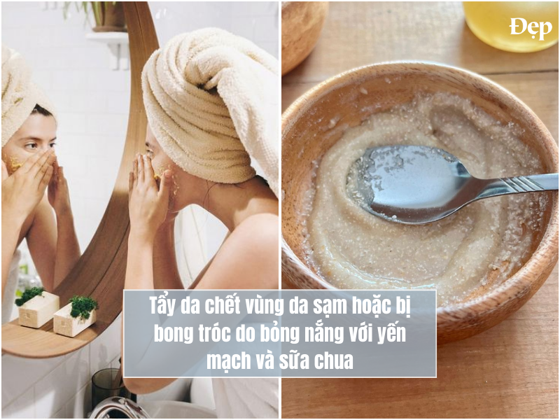 yen-mach-va-sua-chua