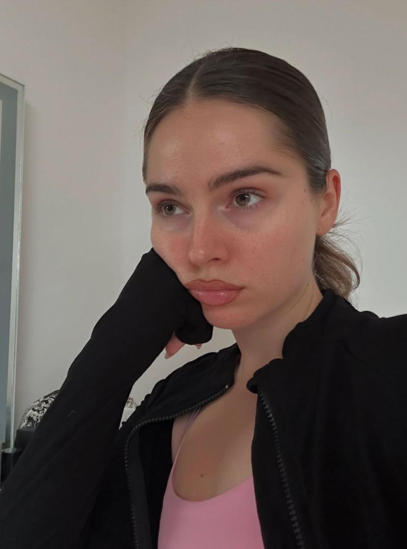 dioic-acid-giup-lam-sang-da-mo-dom-nau