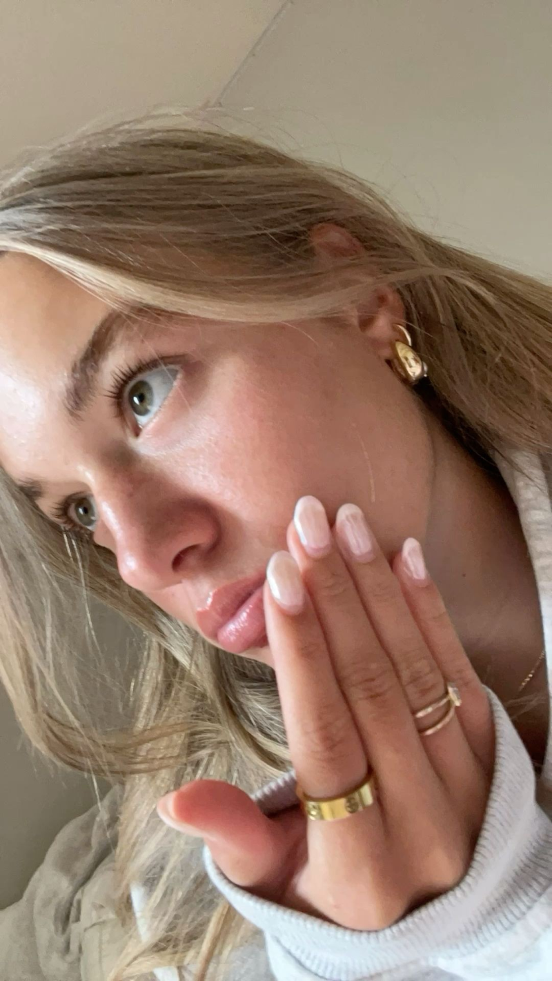 Móng tay bị hư tổn do vi nấm